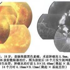 醫(yī)療利器 認(rèn)識(shí)與使用敷貼器